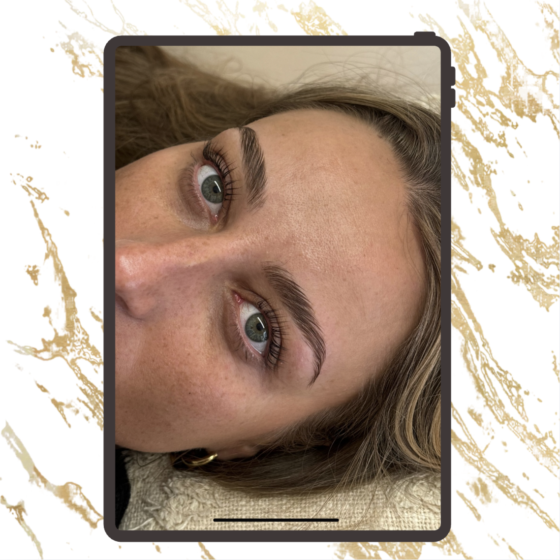 Formation vidéo - Browlift